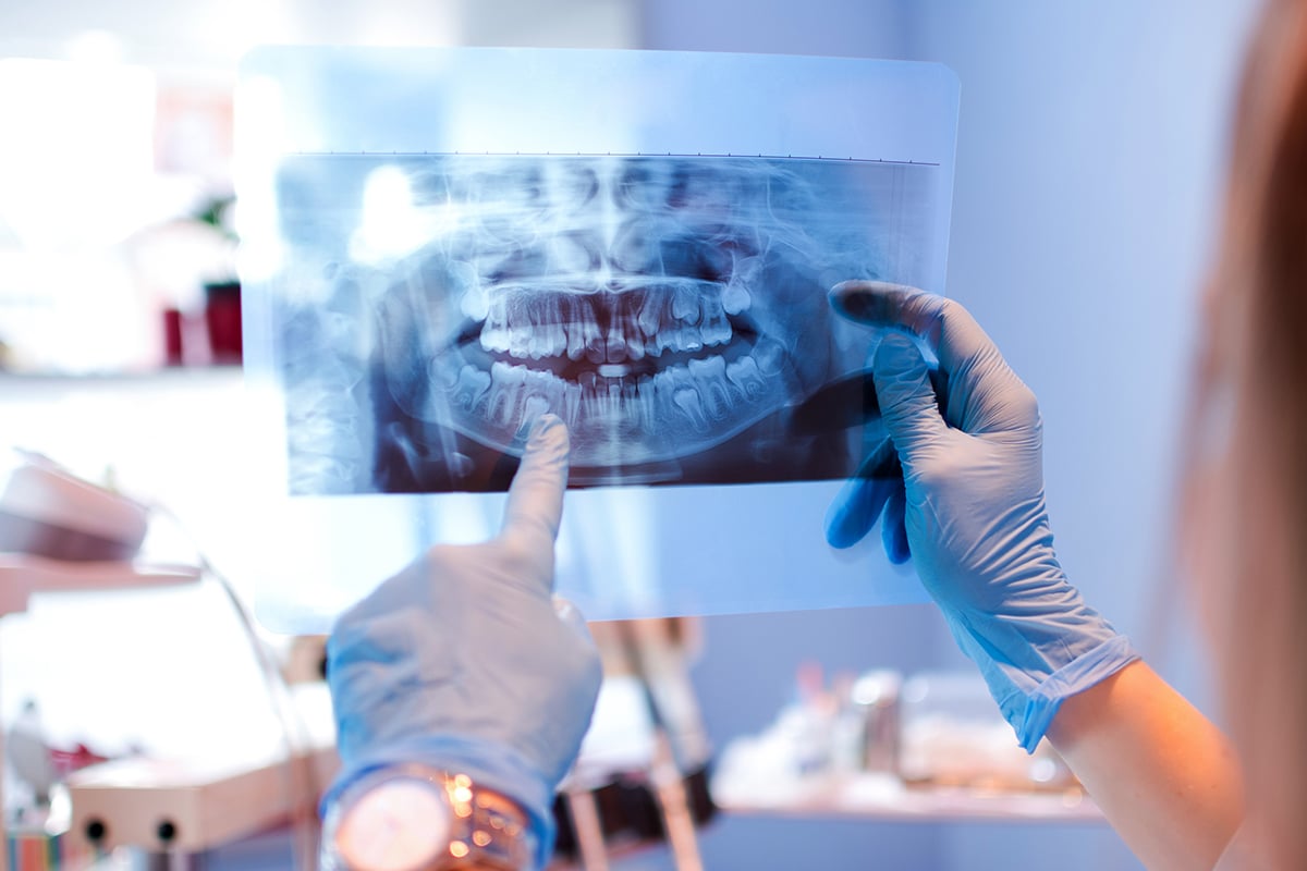 Child's First Dental X-Ray | ABQ Pediatric Dentistry, image size:1200x800