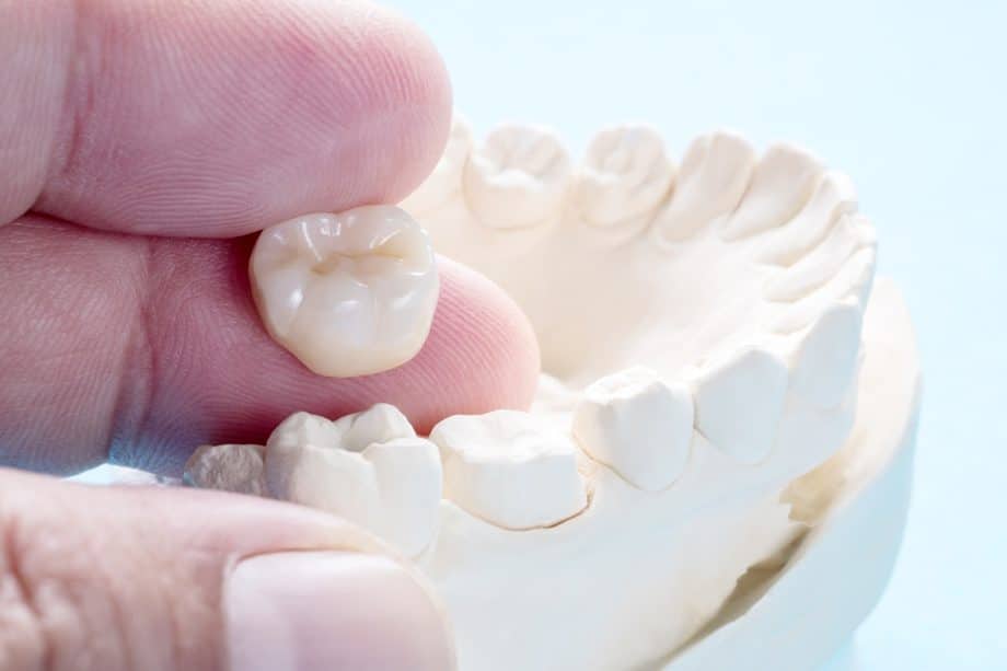 Does Your Child Need a Crown on a Baby Tooth? Here’s What to Expect