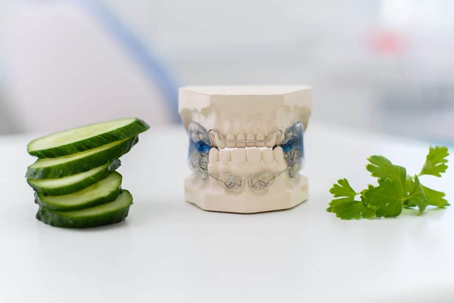 Signs Your Child Might Need Interceptive Orthodontic Treatment Sooner Than You Think